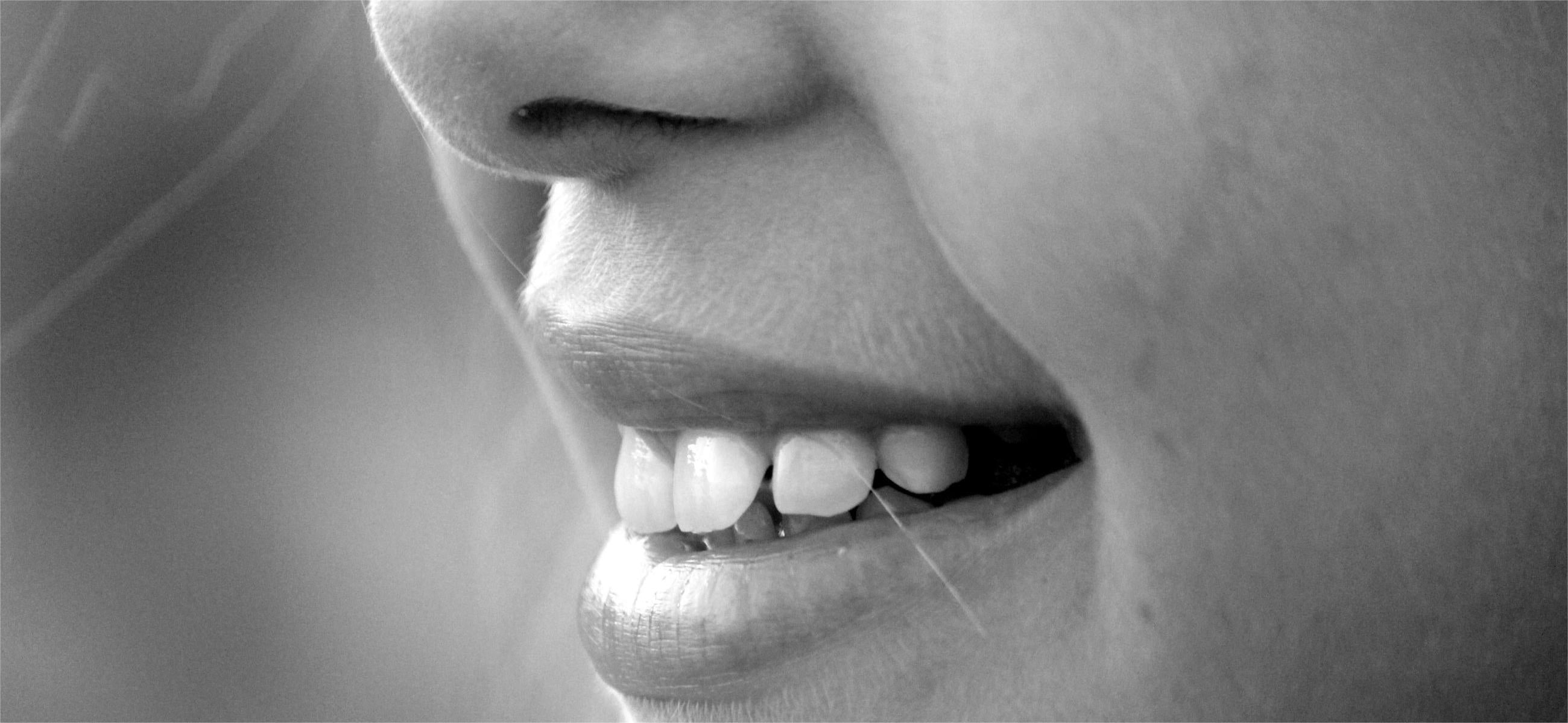 Why are my teeth becoming translucent? Here’s How to Stop It